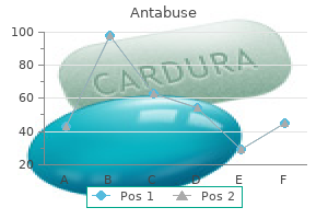 order antabuse 500 mg fast delivery