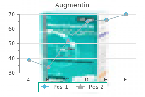 buy discount augmentin 375 mg on-line