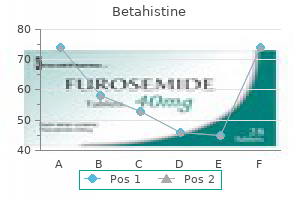 generic betahistine 16mg visa