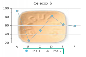 cheap celecoxib 200 mg fast delivery