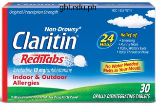 order claritin 10 mg otc