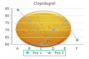 generic clopidogrel 75 mg online