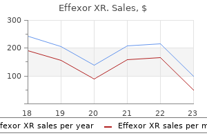 75 mg effexor xr for sale