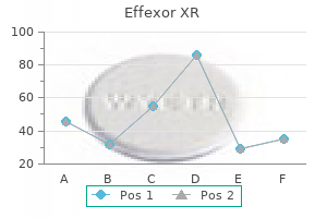 buy cheap effexor xr 150 mg on-line