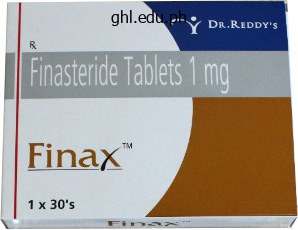 generic finax 1 mg with amex