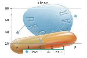 finax 1 mg without prescription