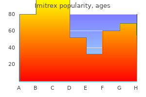 cheap imitrex 25 mg with amex
