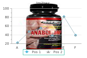 purchase imitrex 50 mg on-line