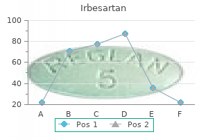 300 mg irbesartan cheap with mastercard