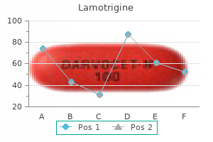 generic 100 mg lamotrigine amex