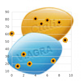 Dandy Walker syndrome recessive form