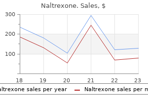 50 mg naltrexone purchase with visa