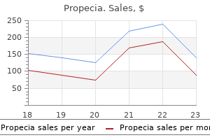 cheap propecia 5 mg mastercard