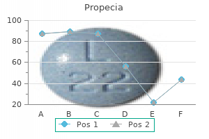 1 mg propecia generic fast delivery