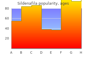 100 mg sildenafila purchase amex