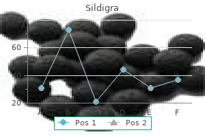 purchase sildigra 100 mg online