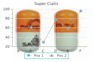 80 mg super cialis discount with visa