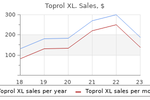 cheap 100 mg toprol xl amex