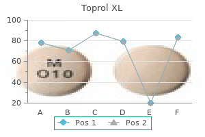 25 mg toprol xl order with visa