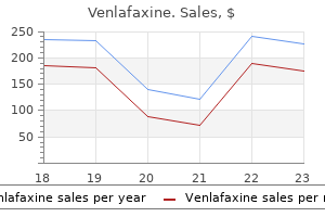 best 150 mg venlafaxine