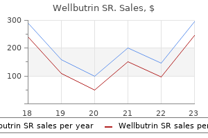 150 mg wellbutrin sr generic otc