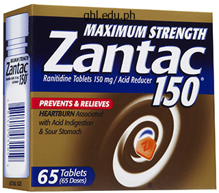 150 mg zantac purchase visa