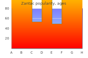 order 150 mg zantac overnight delivery